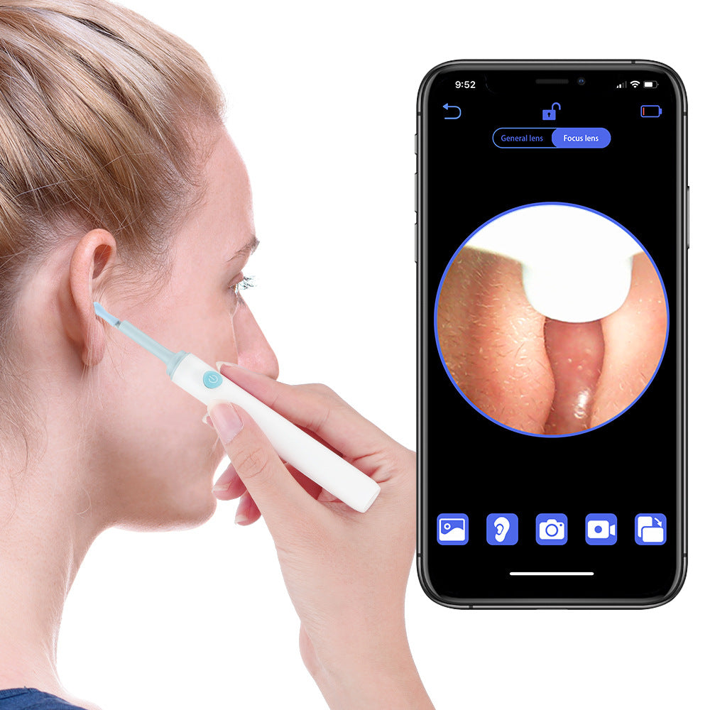 Waterproof Ear Wax Cleaner with Camera and LED Lights